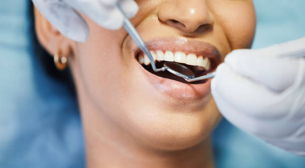 Best Emergency Dental Services for Seniors in Sunnyside, CA